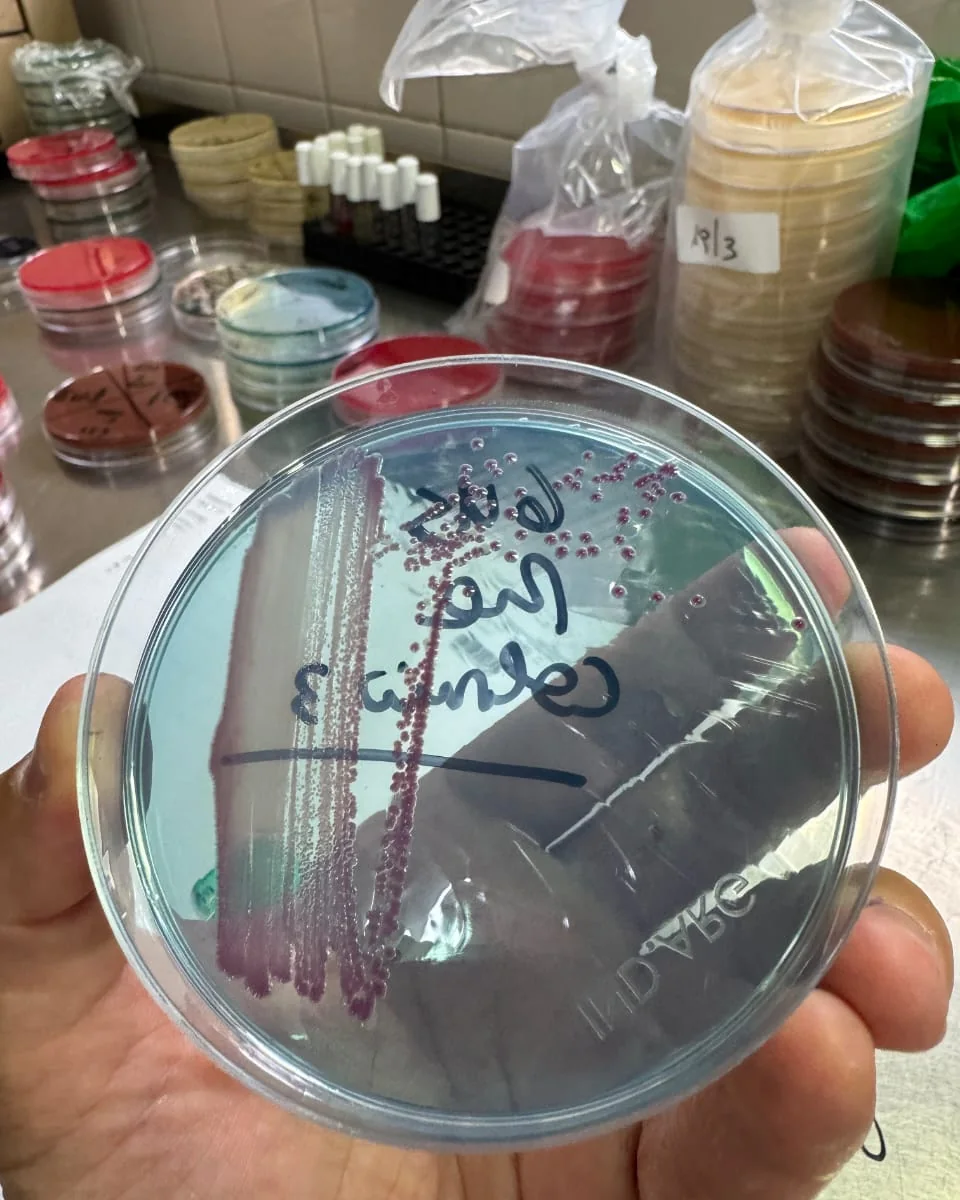 Placa de cultivo con colonias sobre la mesada de microbiología de AV Diagnóstico