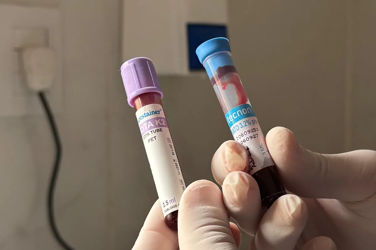 Tubos de EDTA y citrato con la muestra recién extraída, sostenidos con guantes