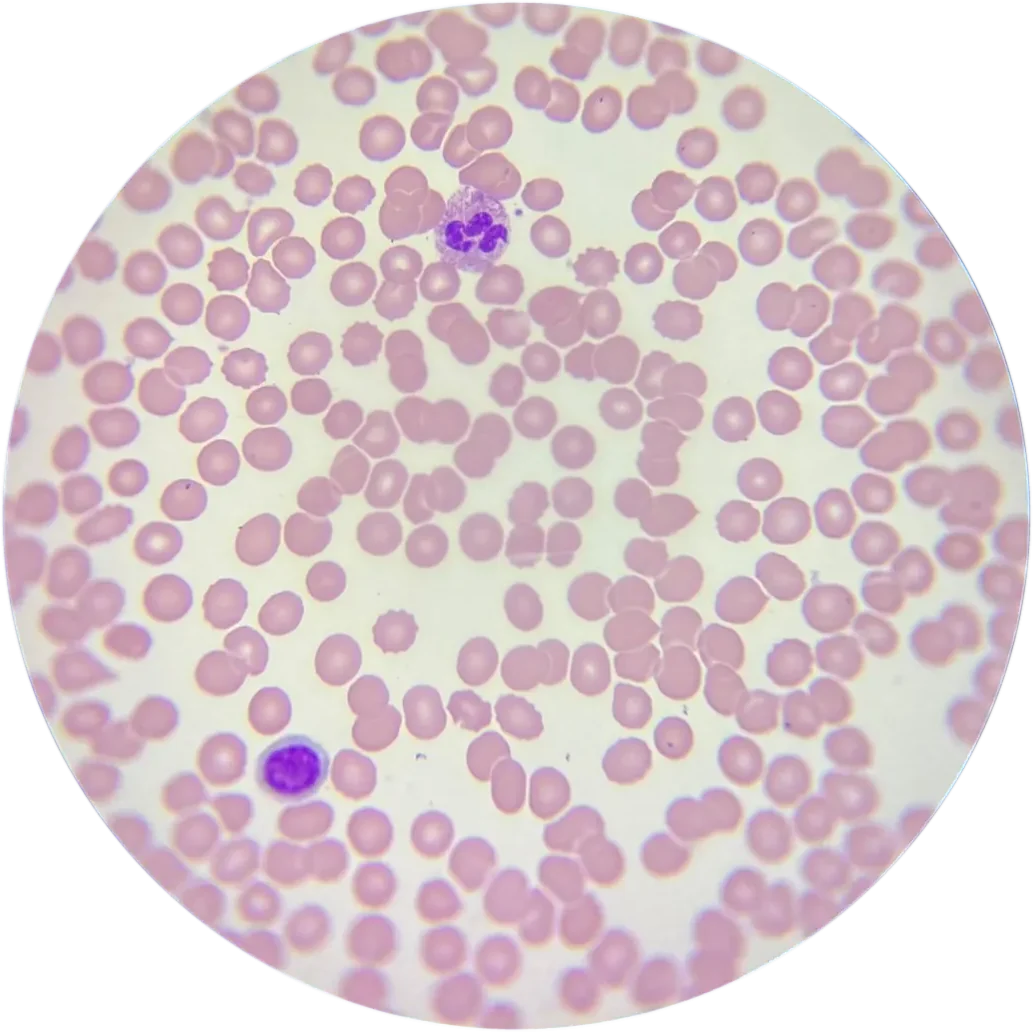 Frotis sanguíneo veterinario al microscopio: serie roja, un neutrófilo y un linfocito