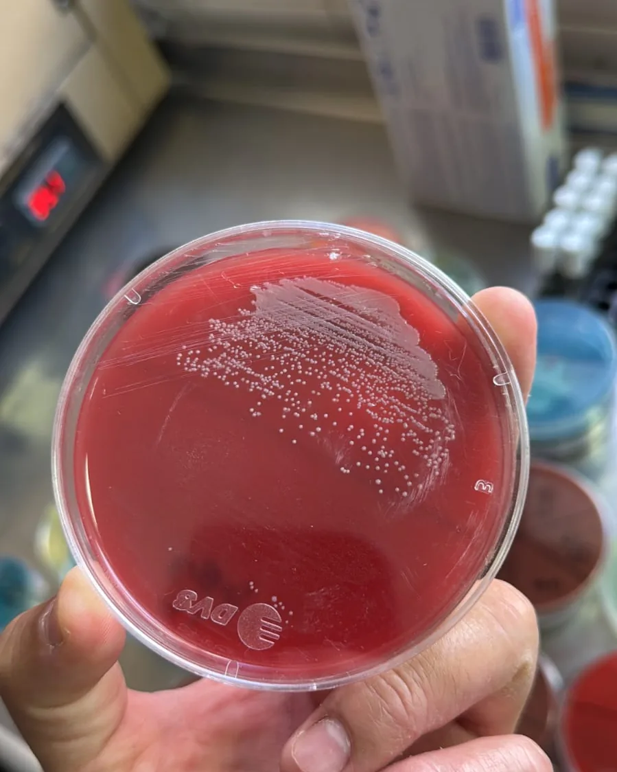 Placa de agar sangre con desarrollo de colonias