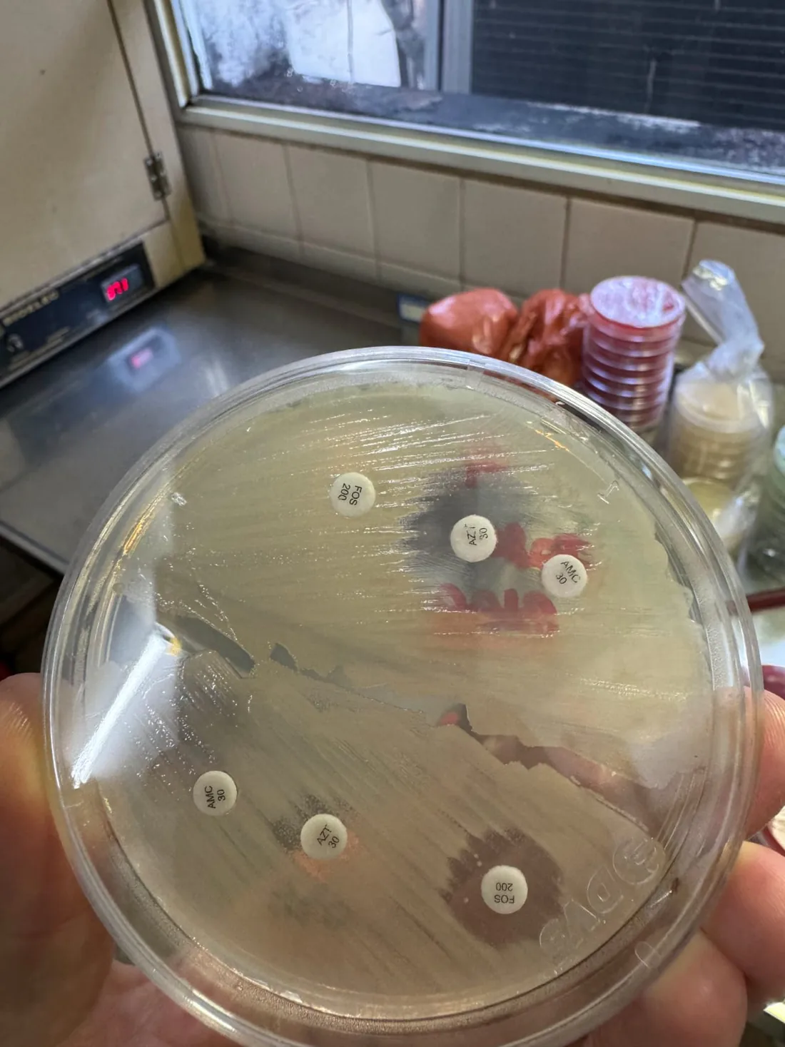 Antibiograma: discos de sensibilidad sobre placa de cultivo