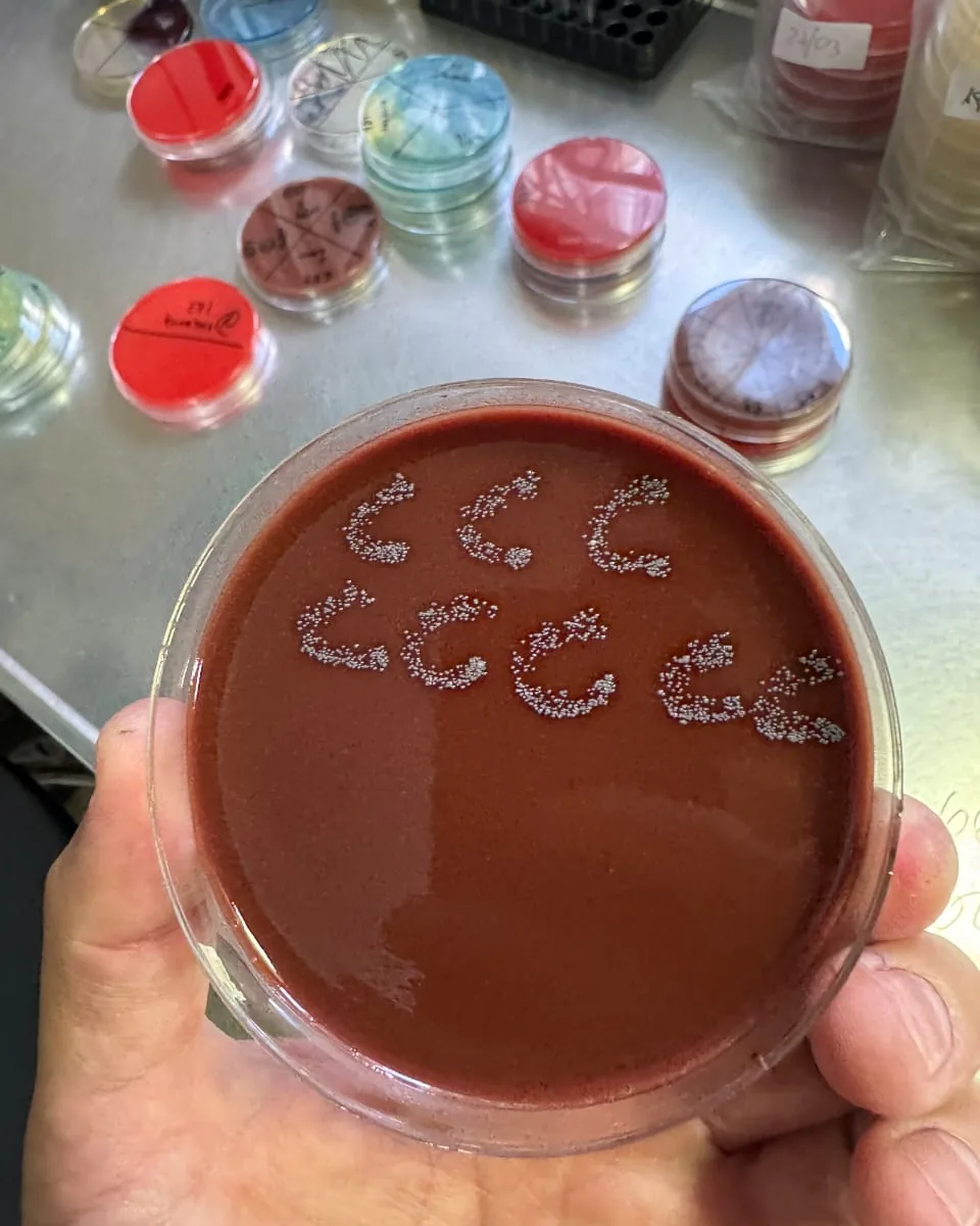 Placa de agar chocolate con colonias sembradas