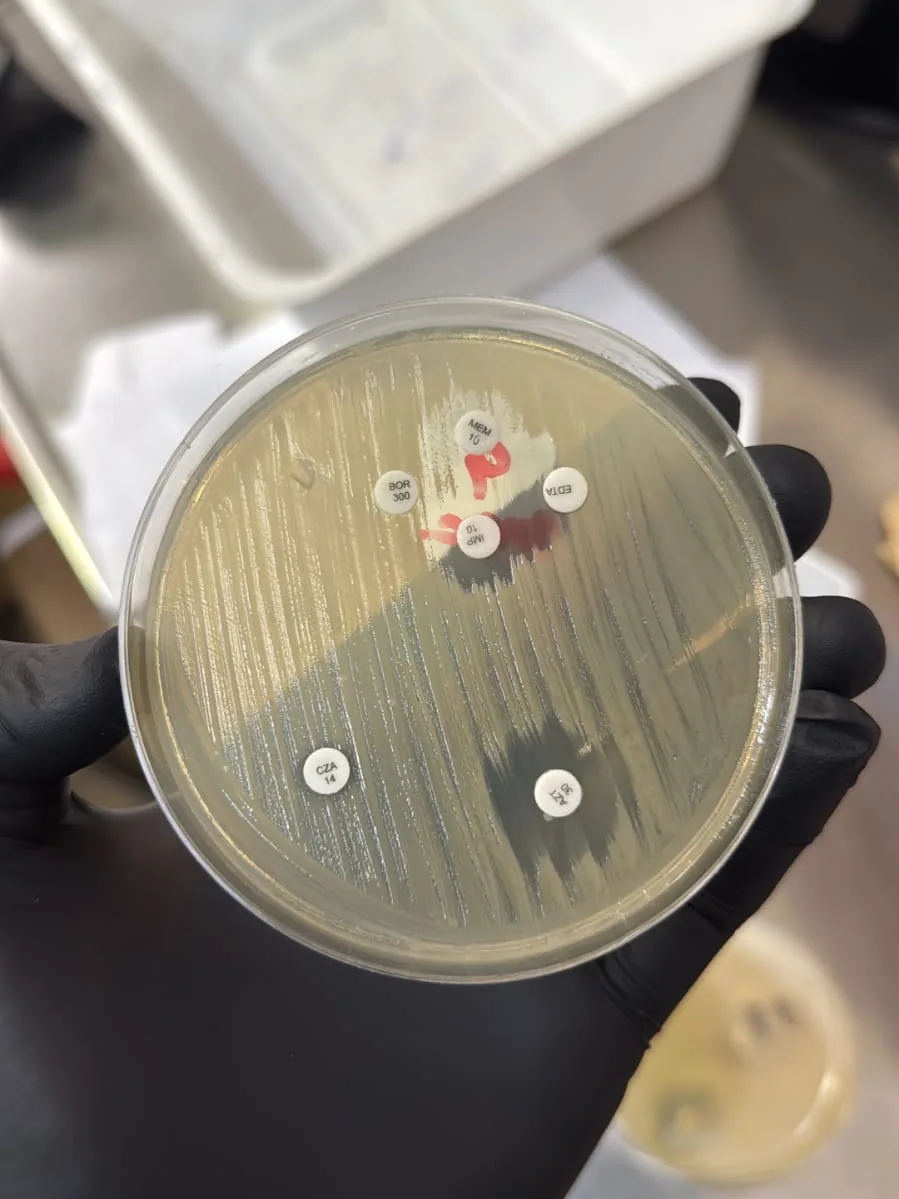 Lectura de halos de inhibición en un antibiograma