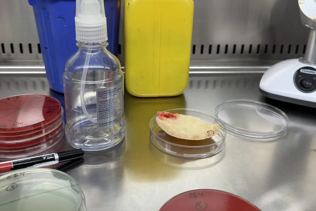 Mesada de microbiología con reactivos y placas de cultivo