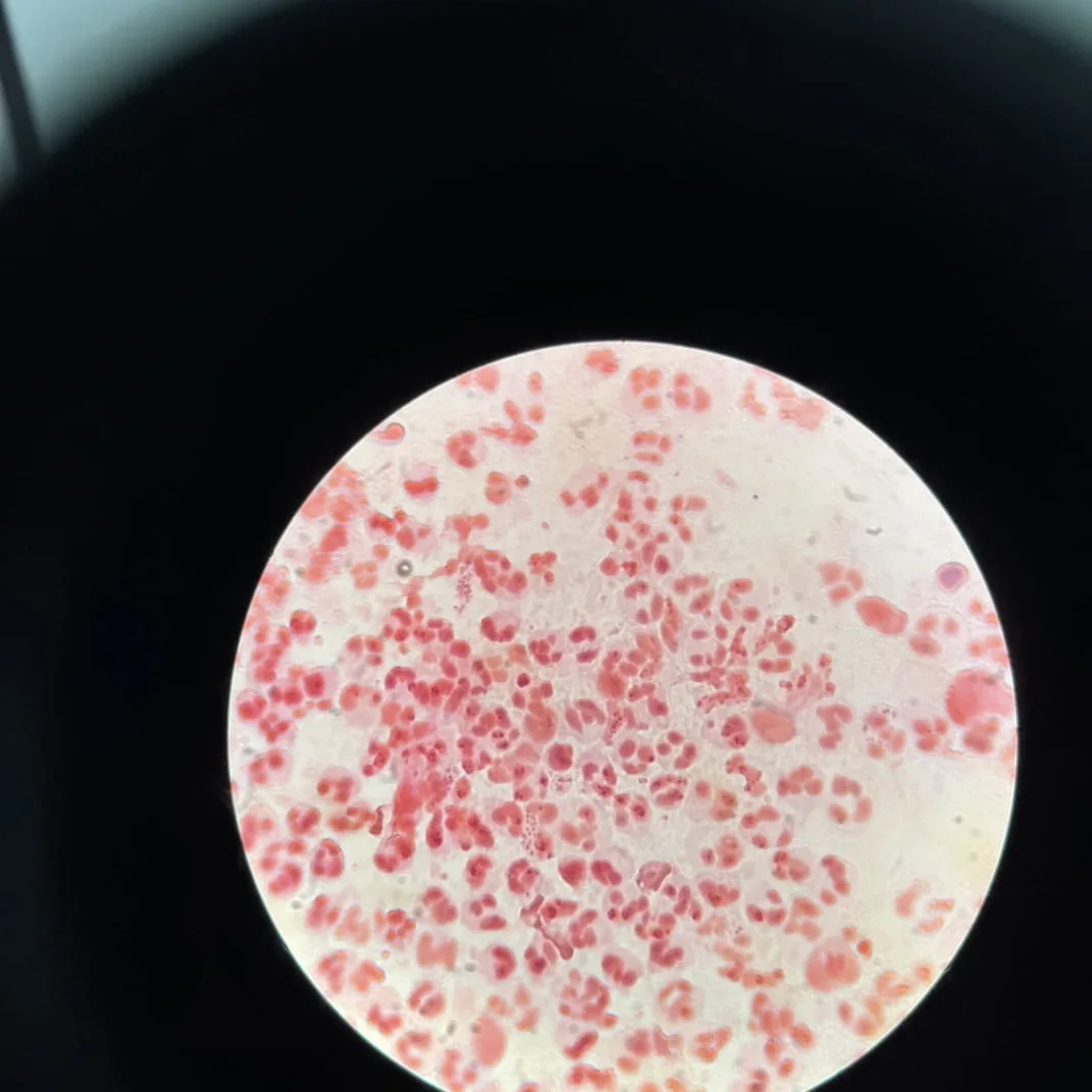 Campo de microscopio: extendido con serie roja