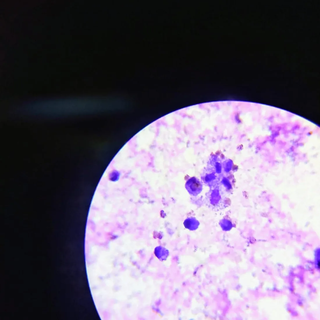Campo de microscopio: extendido teñido con células nucleadas